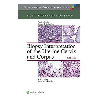 Biopsy Interpretation of the Uterine Cervix and Corpus
