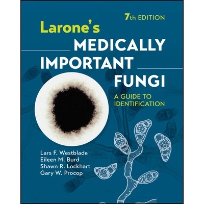 Larone's Medically Important Fungi