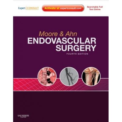 Endovascular Surgery, 4th Edition