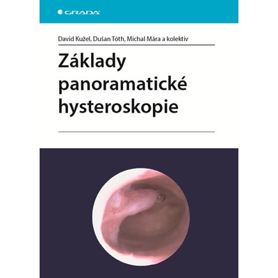 Základy panoramatické hysteroskopie - Dušan Tóth, Doc.MUDr. Michal Mára CSc., David Kužel