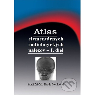 Atlas elementárnych rádiologických nálezov - I. diel - Kamil Zeleňák, Martin Števík a kolektív