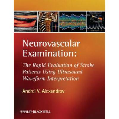 Neurovascular Examination - The Rapid Evaluation of Stroke Patients Using Ultrasound Waveform Interpretation